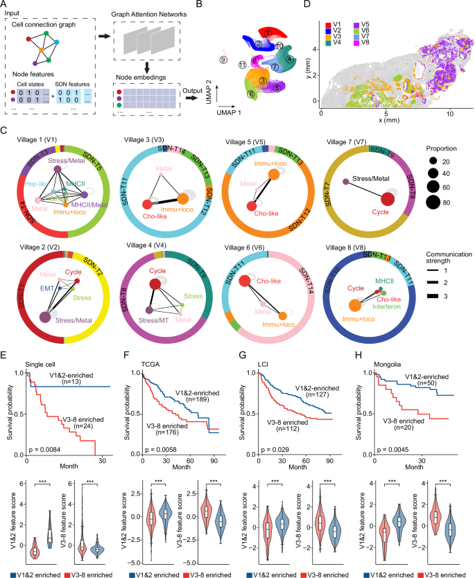 Fig. 5: Tumor cell villages in liver cancer.