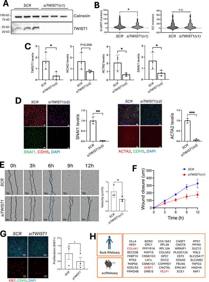 Fig. 3: TWIST1 promotes EndMT, proliferation and migration of arterial EC.