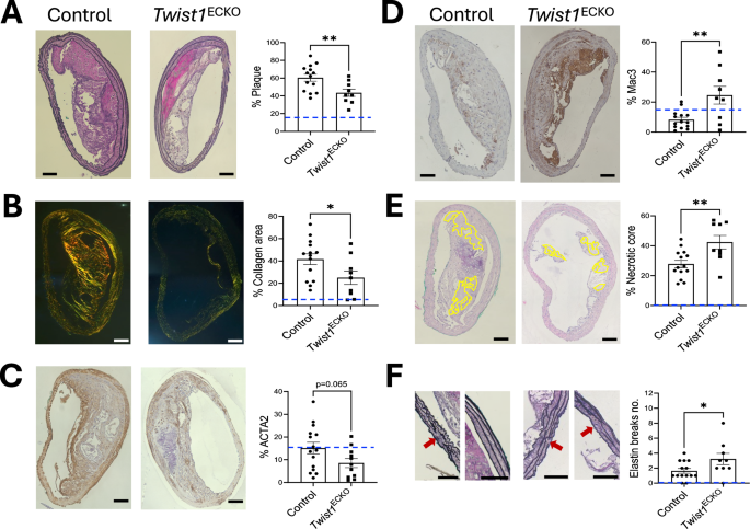 Fig. 6: Twist1 promotes brachiocephalic plaque growth and features of stability in vivo.
