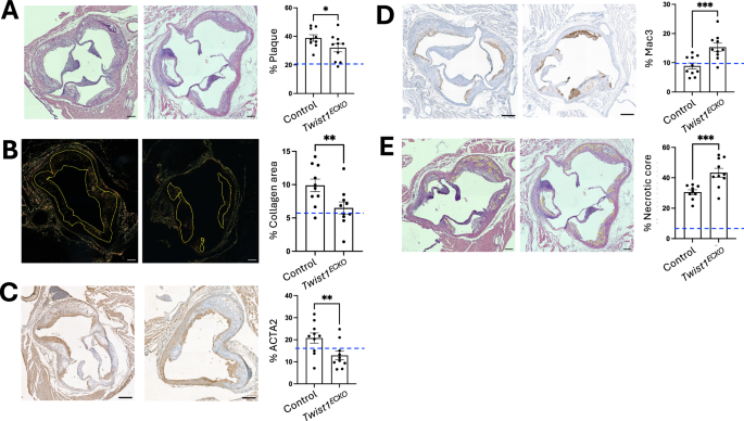 Fig. 7: Twist1 promotes aortic root plaque growth and features of stability in vivo.