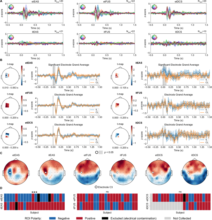 Fig. 2: Transcranial electro-acoustic stimulation (tEAS) induces an exogenous hemisphere-specific response.