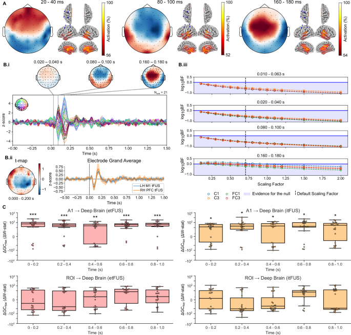 Fig. 4: tFUS induces significant auditory activations.