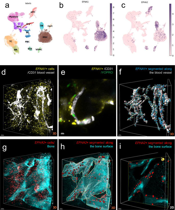 Fig. 3: Expression and localisation of EFNA1 and EPHA2 in human bone.