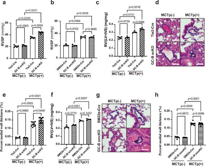 Fig. 2: GC-B signaling in endothelial cells, but not smooth muscle cells, prevents the progression of pulmonary hypertension in the MCTp-induced PAH model.