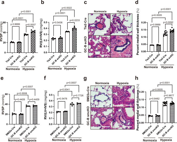 Fig. 3: GC-B signaling in endothelial cells, but not smooth muscle cells, prevents the progression of pulmonary hypertension in Hx-induced model.