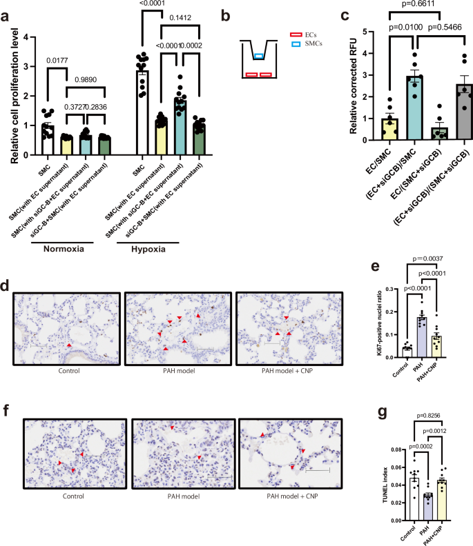 Fig. 7: Endothelial CNP/GC-B signaling restrains PASMC proliferation and migration via paracrine mechanisms.