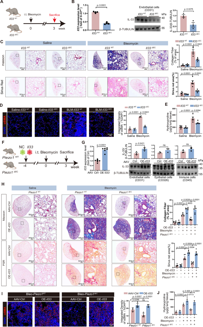 Fig. 6: Endothelial PIEZO1 Regulated Pulmonary Fibrosis Required IL-33.