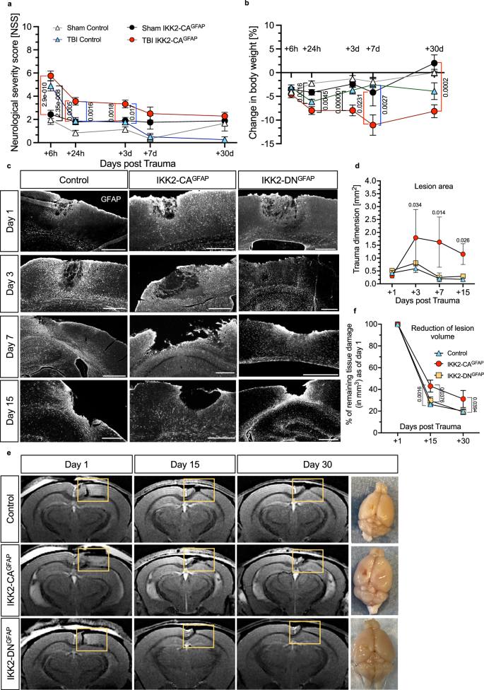 Fig. 3: NF-κB pre-activation in astrocytes affects TBI outcome and impairs wound lesion restoration after TBI.