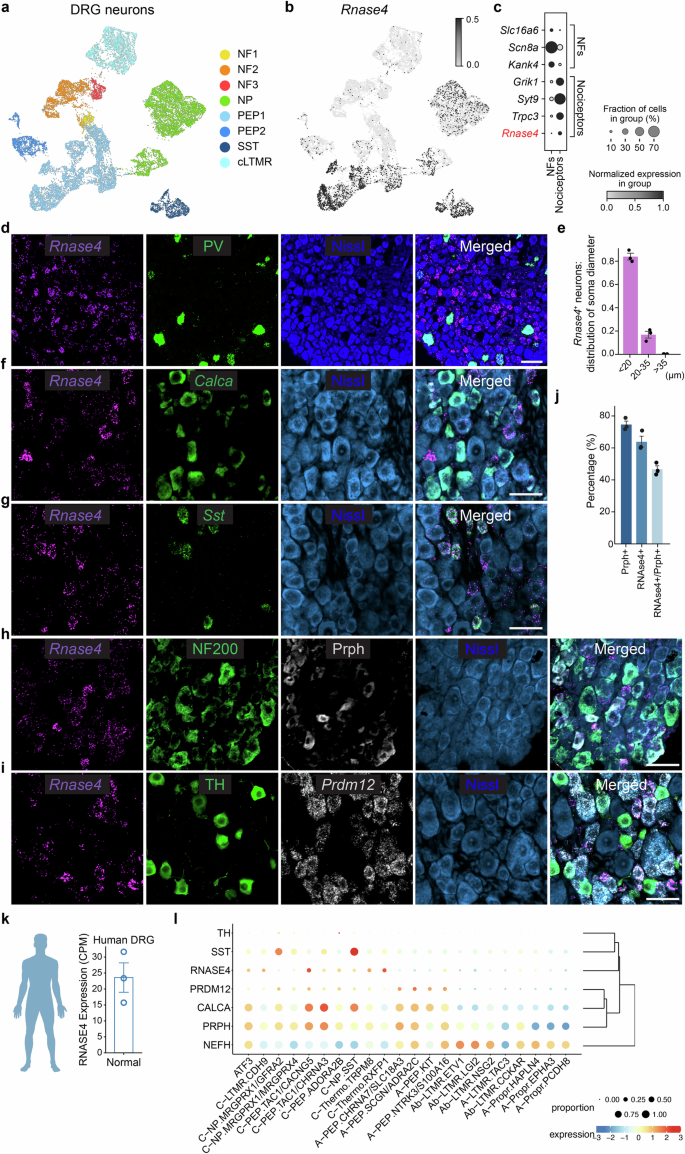 Fig. 1: Neuronal Subtypes and RNase4 Expression in the DRG.