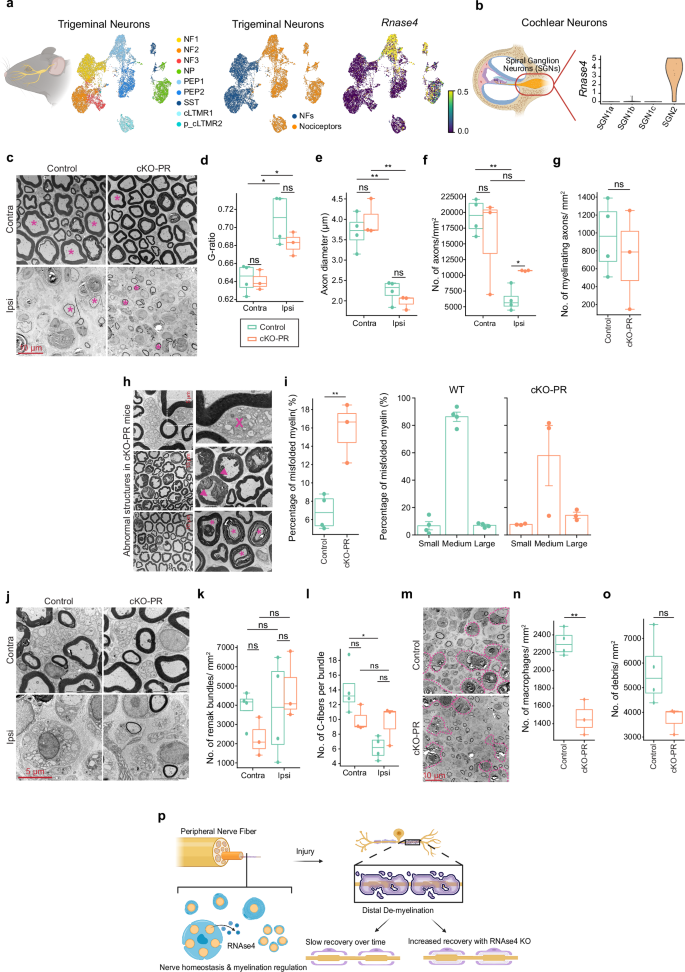 Fig. 7: Non-cell-autonomous effects of RNase4 removal in nociceptors: impact on axon diameter, myelin formation, and injury response.