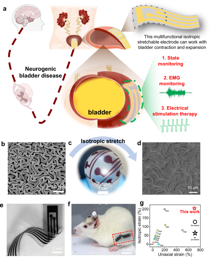 Fig. 1: A bladder-machine interface (BdMI) utilizing intrinsically isotropic stretchable thin-film patches for the multimodal, chronically implantable treatment of neurogenic bladder dysfunction.