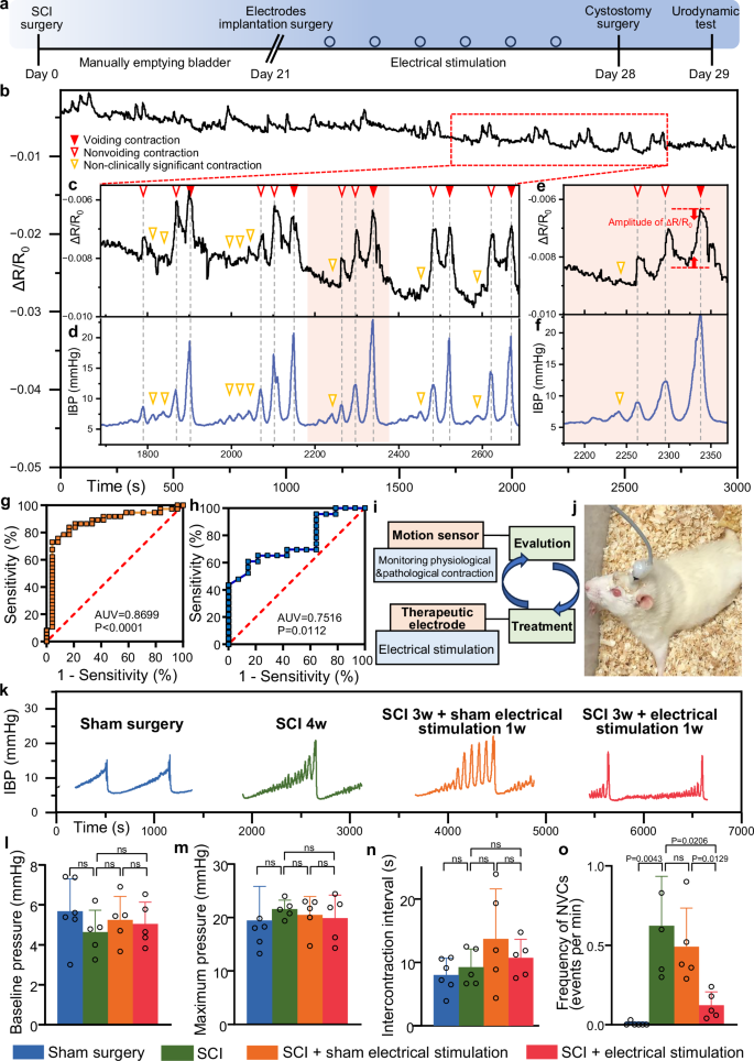 Fig. 5: Assessment and modulation of neurogenic bladder dysfunction following spinal cord injury (SCI).