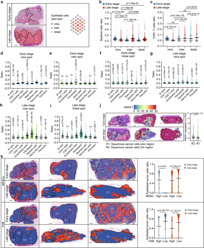 Fig. 4: MDSCs but not TAM are the major subtype of myeloid cells accumulated in tumor cells-rich region in early-stage OSCC.
