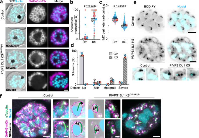 Fig. 8: PfVPS13L1 is essential for IMC extension and schizont segmentation.