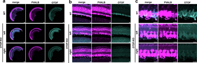 Fig. 7: Immunofluorescence analysis of otoferlin expression in the cochlea.