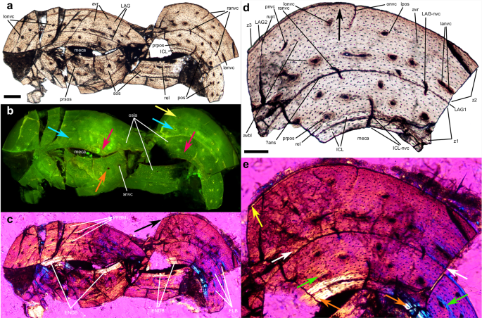 Fig. 3: Histology of the left radius of 130108-MHGU-F4281.
