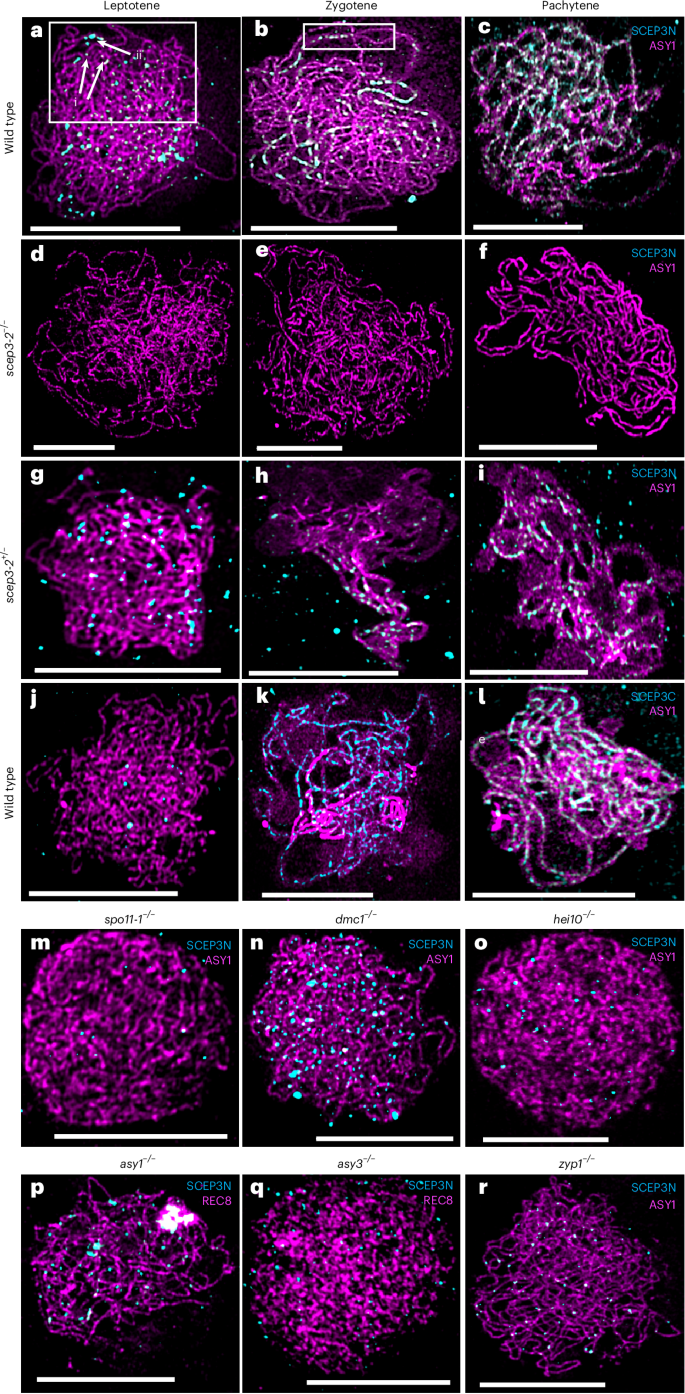 Fig. 2: SCEP3 localizes to meiotic chromosomes at prophase I.