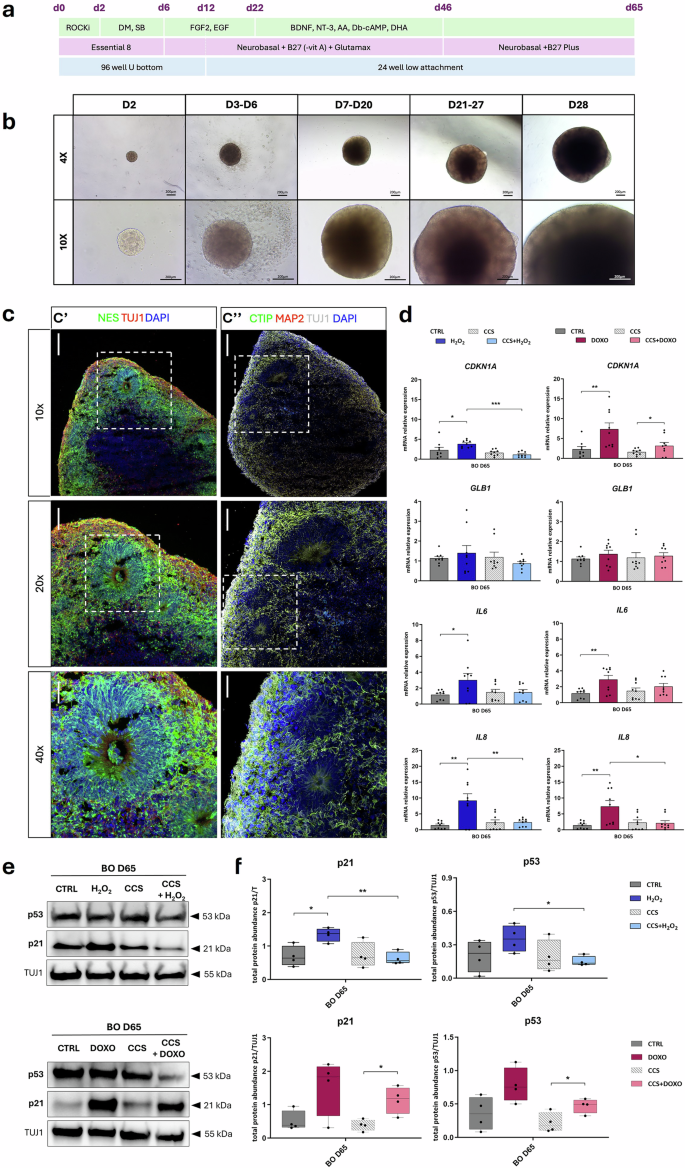 Fig. 4: p300 inhibition by CCS1477 rescues the senescent-like phenotype induced by SIPS agents in Brain Organoids (BOs).