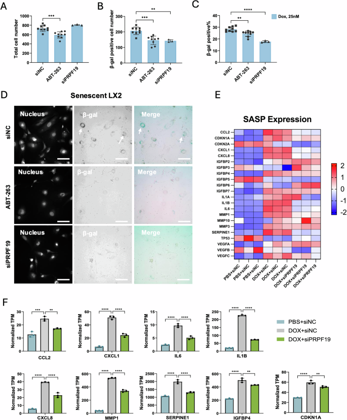Fig. 2: In vitro validation of PRPF19 on the impact of cellular senescence on hepatic stellate cells.