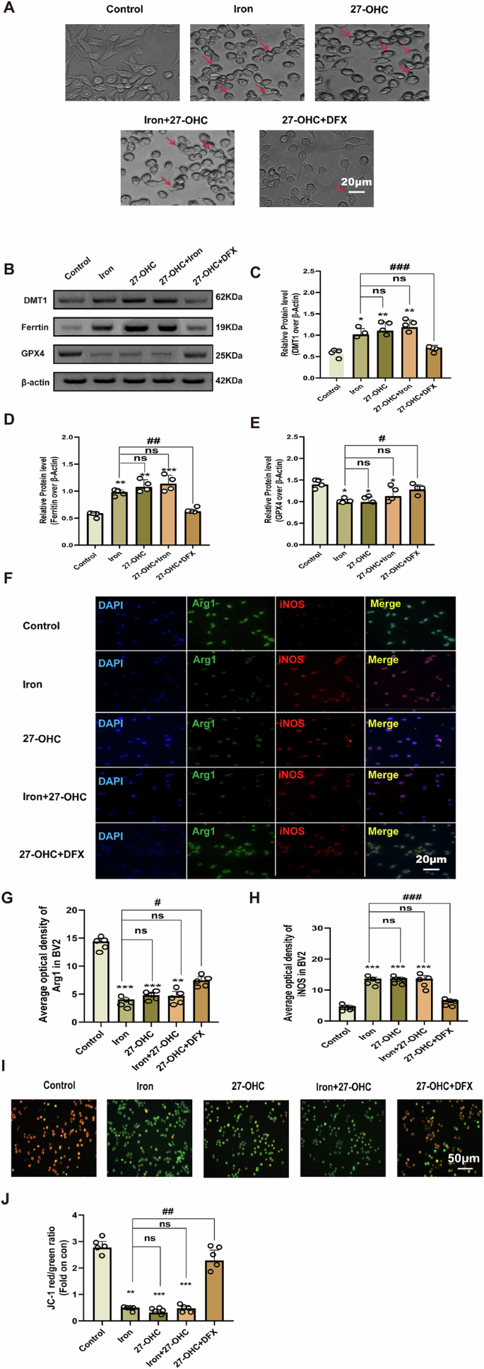 Fig. 8: Interventive effect of DFX on iron metabolism in BV-2 cells.