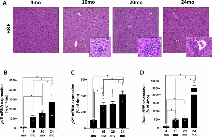 Fig. 1: Markers of inflammation and liver damage and TNFα expression in livers of aging male C57BL/6J mice.