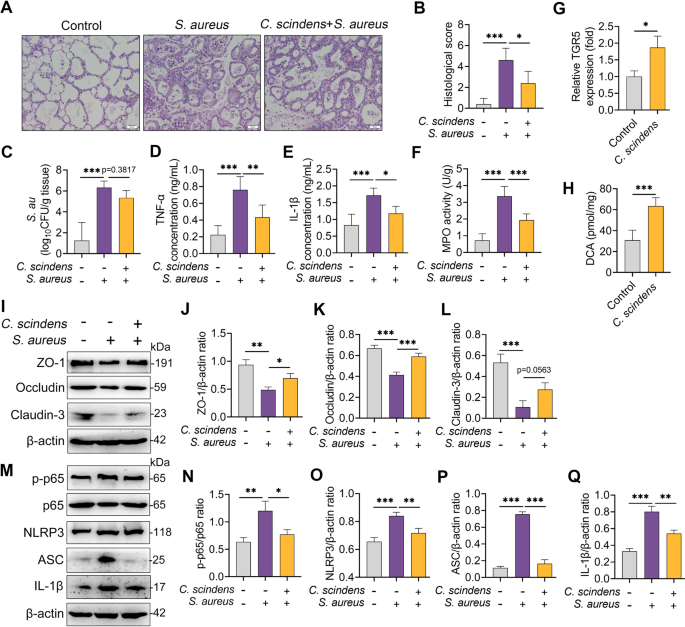 Fig. 7: Clostridium scindens with DCA-producing capacity alleviates S. aureus-induced mastitis in mice.