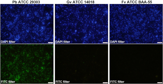 Fig. 1: Fluorescence microscopy results of P. bivia PbivPNA1454 probe hybridization.