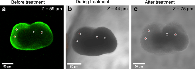 Fig. 3: Representative images of beads trapped in P. aeruginosa ΔmucA biofilm microcolonies before, during and after treatment with NAC.