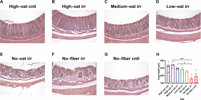 Fig. 1: Dietary fiber deficiency damages intestinal morphology.
