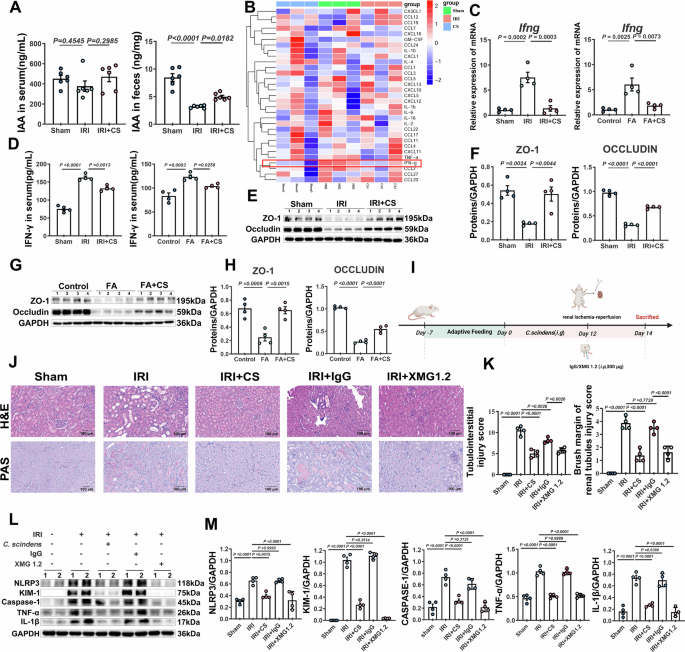 Fig. 4: Effects of CS on IAA levels, cytokine expression, and intestinal barrier integrity in AKI models.
