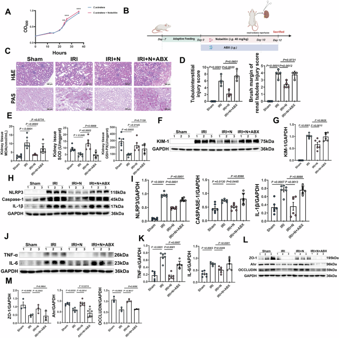 Fig. 6: Nobiletin ameliorates IRI-induced acute kidney injury via modulating gut microbiota.