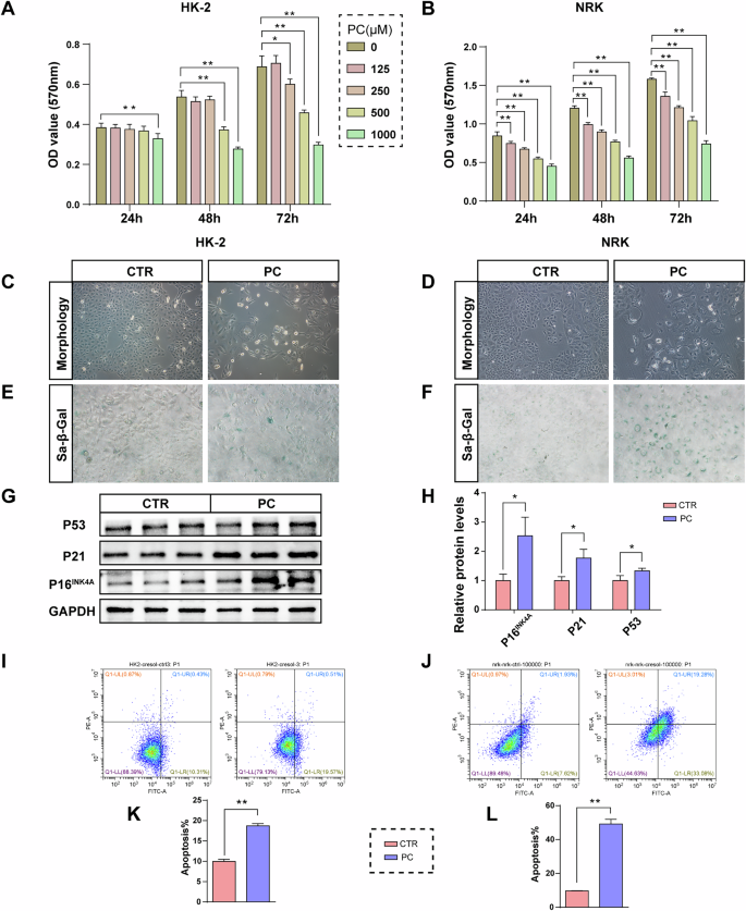 Fig. 11: PC promotes renal tubular cell senescence and apoptosis.