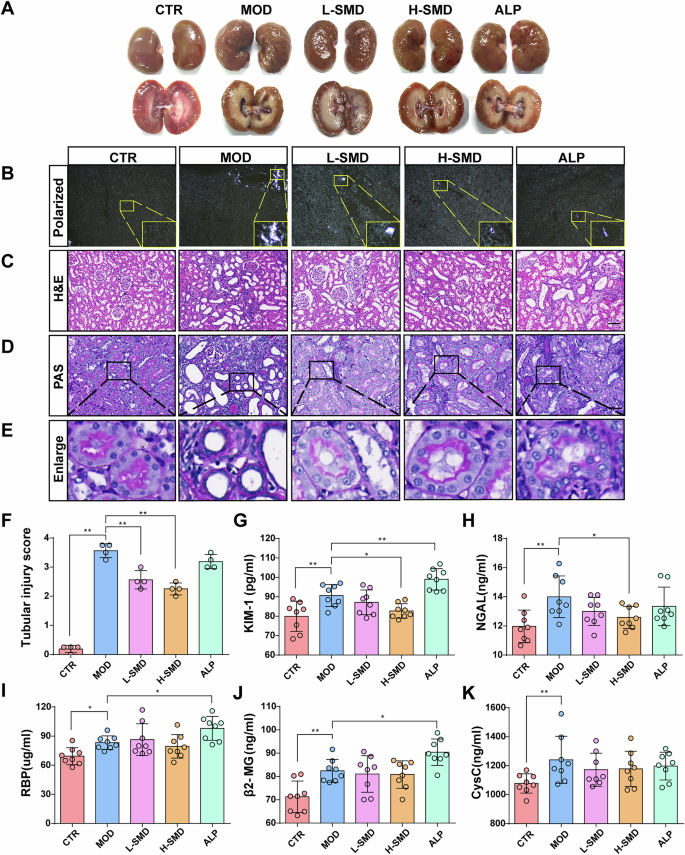Fig. 2: SMD attenuates renal histopathological injury in the UOX-/- rats.