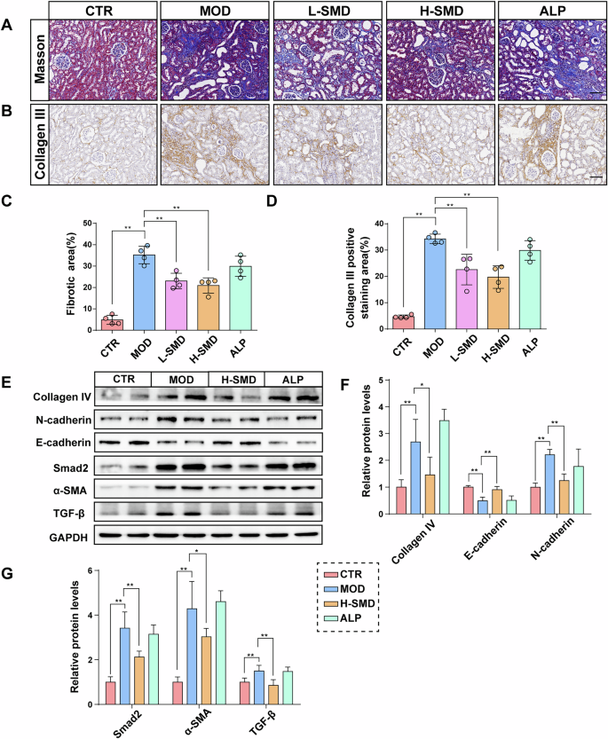 Fig. 3: SMD alleviates renal fibrosis in the UOX−/− rats.