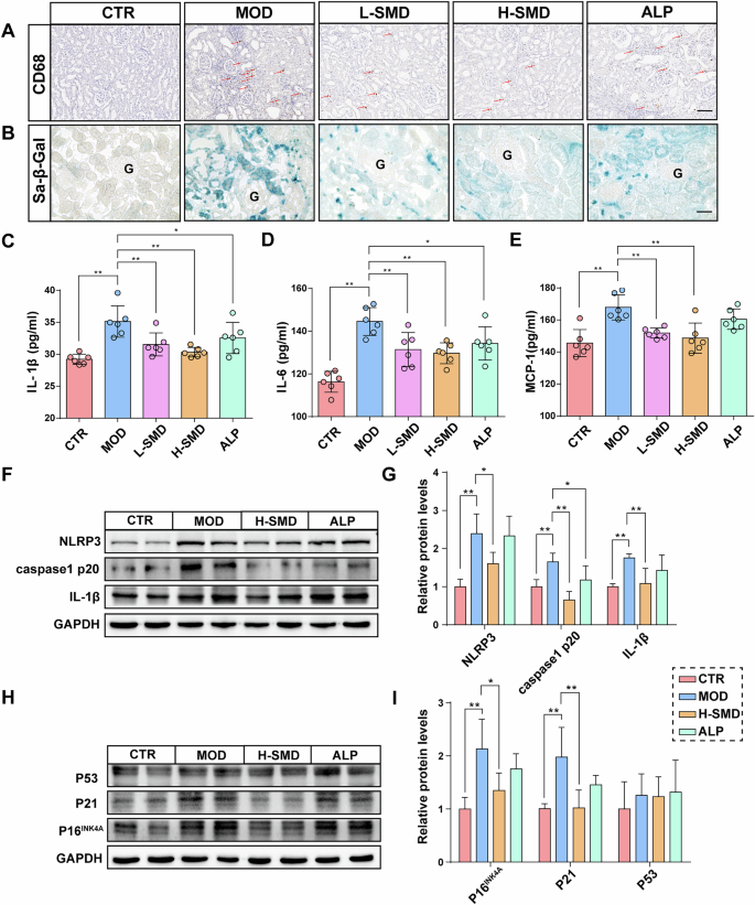 Fig. 4: SMD inhibits inflammation and cellular senescence in the kidneys of UOX−/− rats.