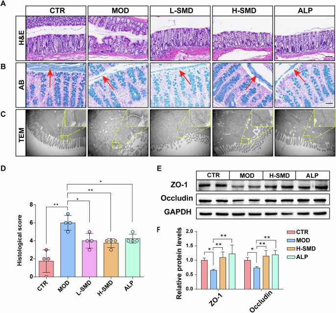 Fig. 5: SMD improves intestinal barrier in the UOX−/− rats.