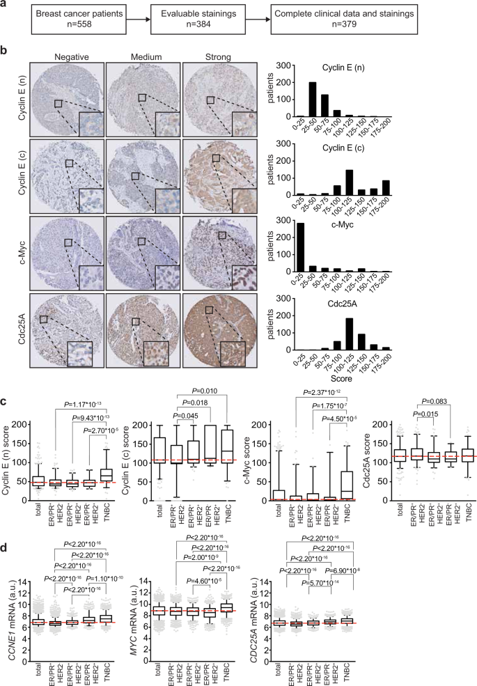 Cyclin E Expression Is Associated With High Levels Of Replication Stress In Triple Negative Breast Cancer Npj Breast Cancer