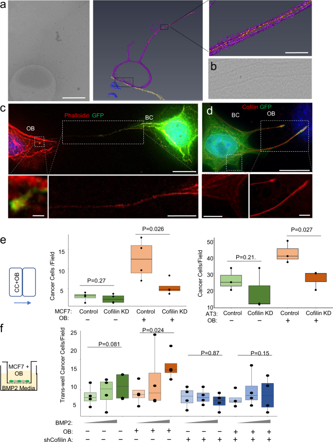 Unique cellular protrusions mediate breast cancer cell migration by  tethering to osteogenic cells | npj Breast Cancer