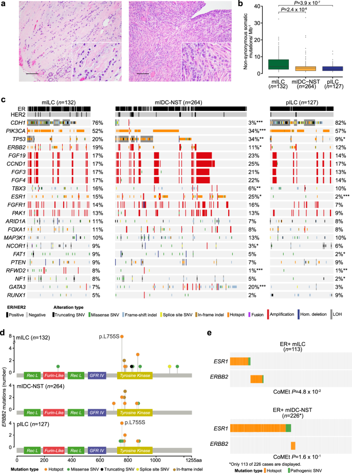Fig. 1: Repertoire of genetic alterations in primary and metastatic invasive lobular carcinomas of the breast.