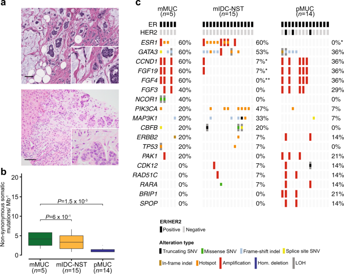 Fig. 2: Repertoire of genetic alterations in primary and metastatic mixed mucinous breast cancers.