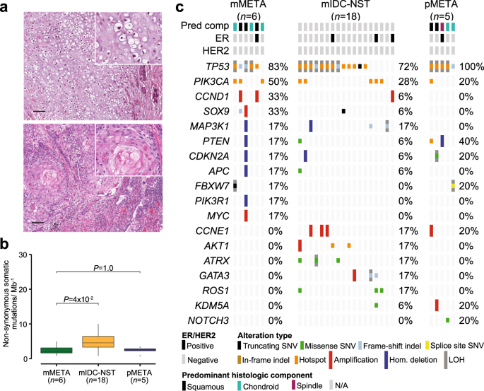 Fig. 4: Repertoire of genetic alterations in primary and metastatic metaplastic breast cancers.