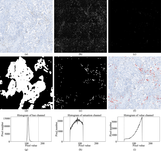 Fig. 2: Visual results of our AI-assisted PD-L1 scoring model.