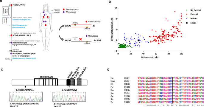 Fig. 1: Breast cancer FA663 patient diagnosed with biallelic BRCA2-FA disorder.