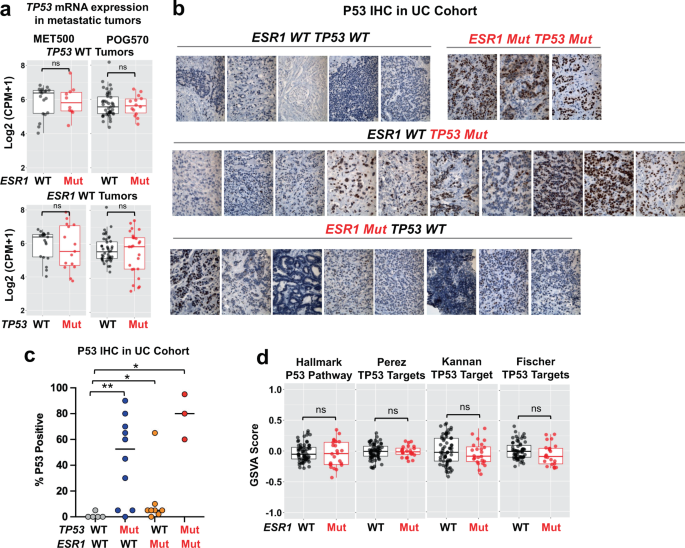 Fig. 2: ESR1 mutations do not affect TP53 expression or TP53 pathway activity in TP53 WT ER + metastatic tumors.