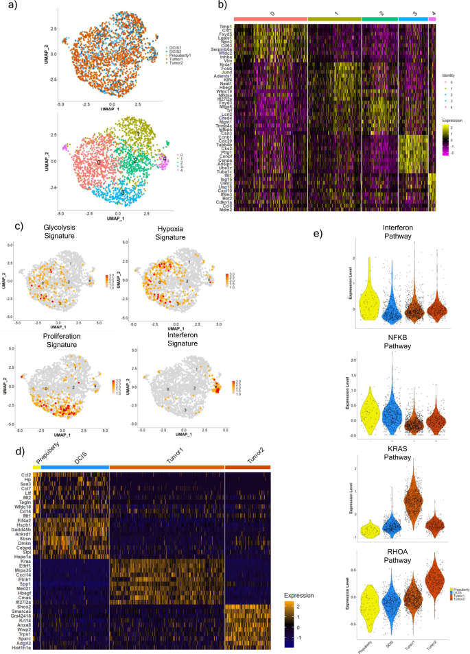 Fig. 2: The different subpopulations and gene pathways identified in copy number high C3Tag cancer cells across the disease states.