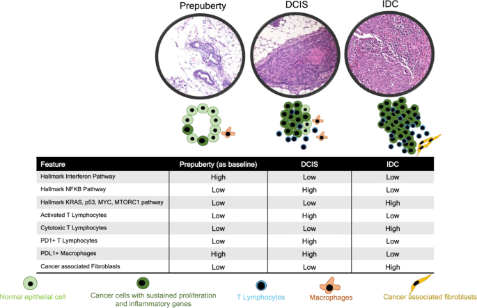 Fig. 5: Schematic diagram of DCIS-IDC progression based upon the C3Tag model.