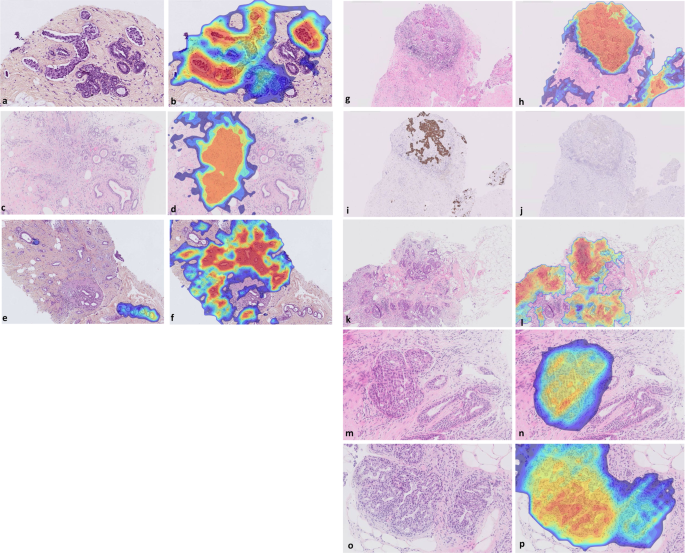 Fig. 3: Examples of misdiagnoses identified by the algorithm.