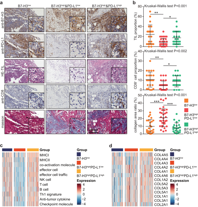 Fig. 4: TIME features of three subtypes divided by the combination of B7-H3/PD-L1.