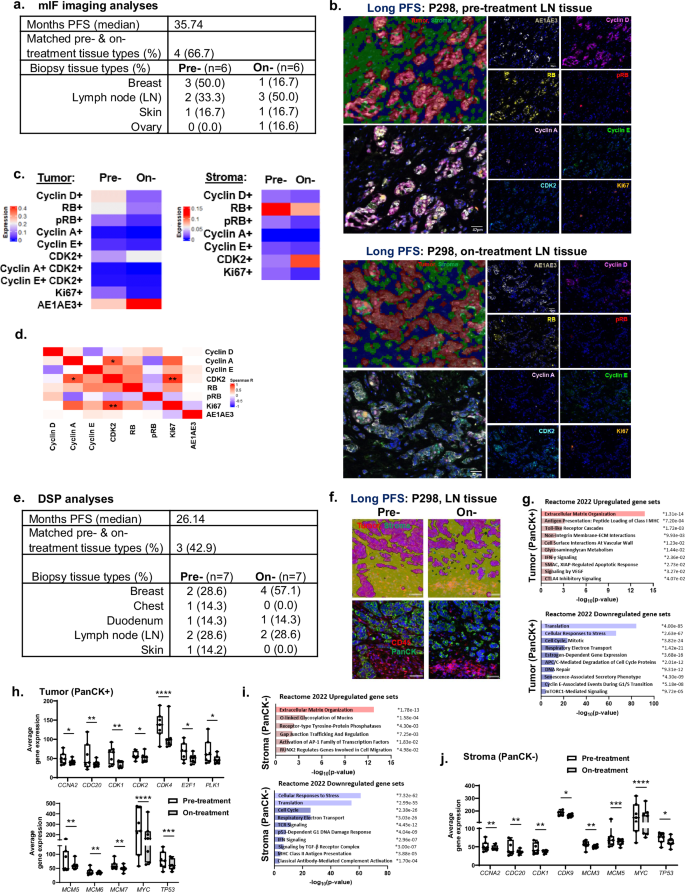 Fig. 4: Low levels of pRB or Ki67 observed in CDK4/6i-treated tumors and stroma across tissue types of patients with long PFS.
