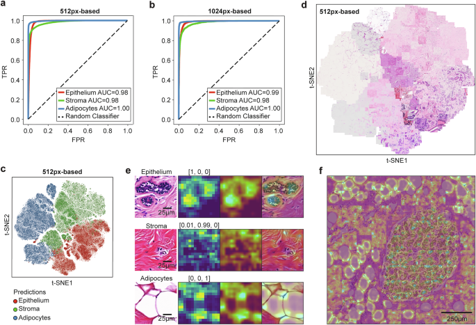 Fig. 2: NBT-Classifiers demonstrate high generalisability based on robust normal breast features.